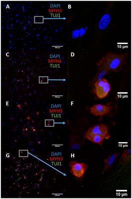 Transdifferentiating Astrocytes Into Neurons Using ASCL1 Functionalized With a Novel Intracellular Protein Delivery Technology